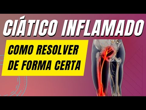 Como a injeção pode ajudar no tratamento do nervo ciático inflamado?