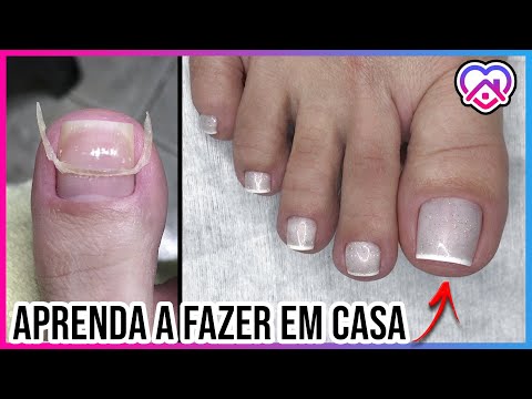 Como cuidar de unha do pé delicada?