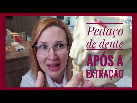 Como remover o resto de dente que ficou na gengiva?