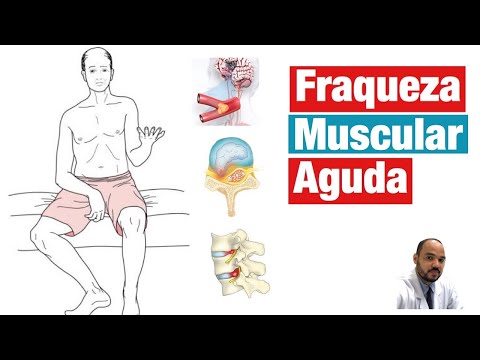 Fraqueza no corpo: o que pode ser?