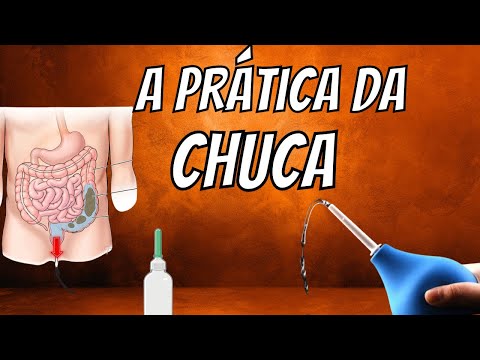 O que é chuca e como ela é utilizada?