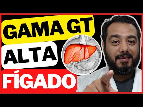 O que significa a gama GT acima de 100?