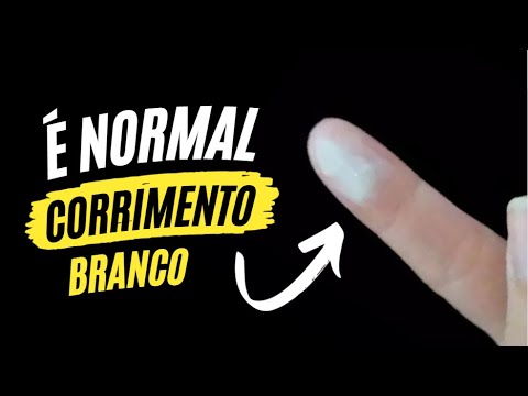 O que significa corrimento branco e quais são suas causas?