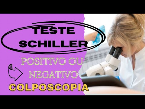 O que significa um teste de Schiller positivo?