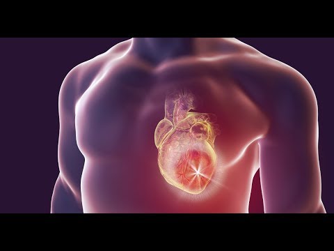 O que uma pessoa sente realmente ao morrer de infarto fulminante?