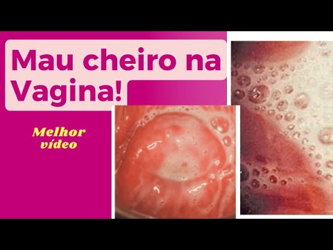 Por que há cheiro forte na vagina?