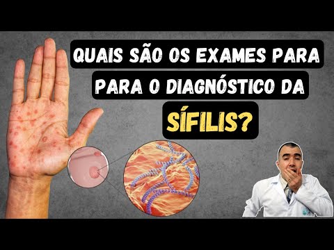 Quais doenças o exame VDRL consegue detectar?