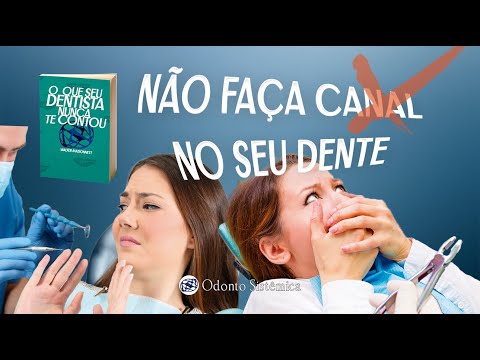 Quais são as fotos de dentes que precisam de tratamento de canal?