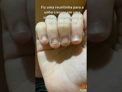 Quais são as melhores ideias de unhas simples?