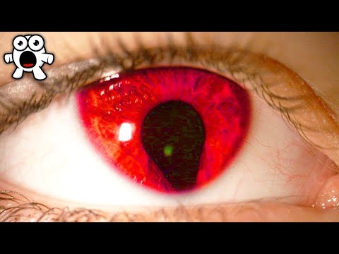 Quais são os olhos mais raros do mundo?