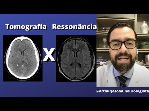 Qual é a diferença entre tomografia e ressonância?