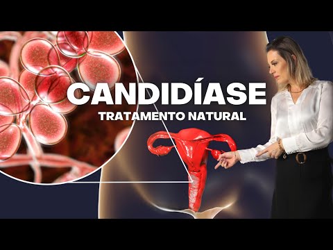 Qual é o melhor remédio caseiro para candidíase?