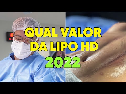 Qual é o valor de uma lipoaspiração na barriga?