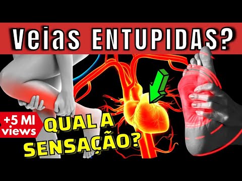 Qual perna passa a veia do coração?