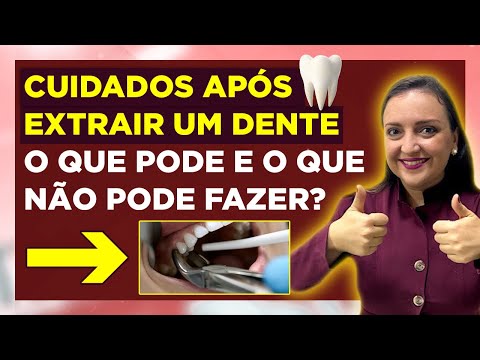 Quando posso voltar a comer normalmente após a extração do dente?