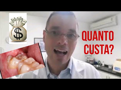 Quanto Custa para Arrancar um Dente?