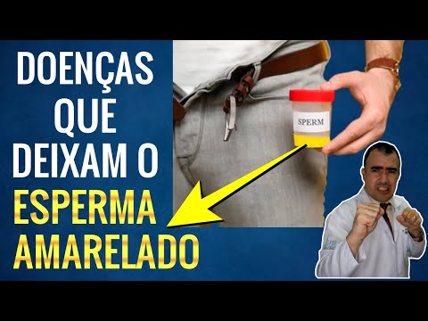 Sêmen amarelado é normal?